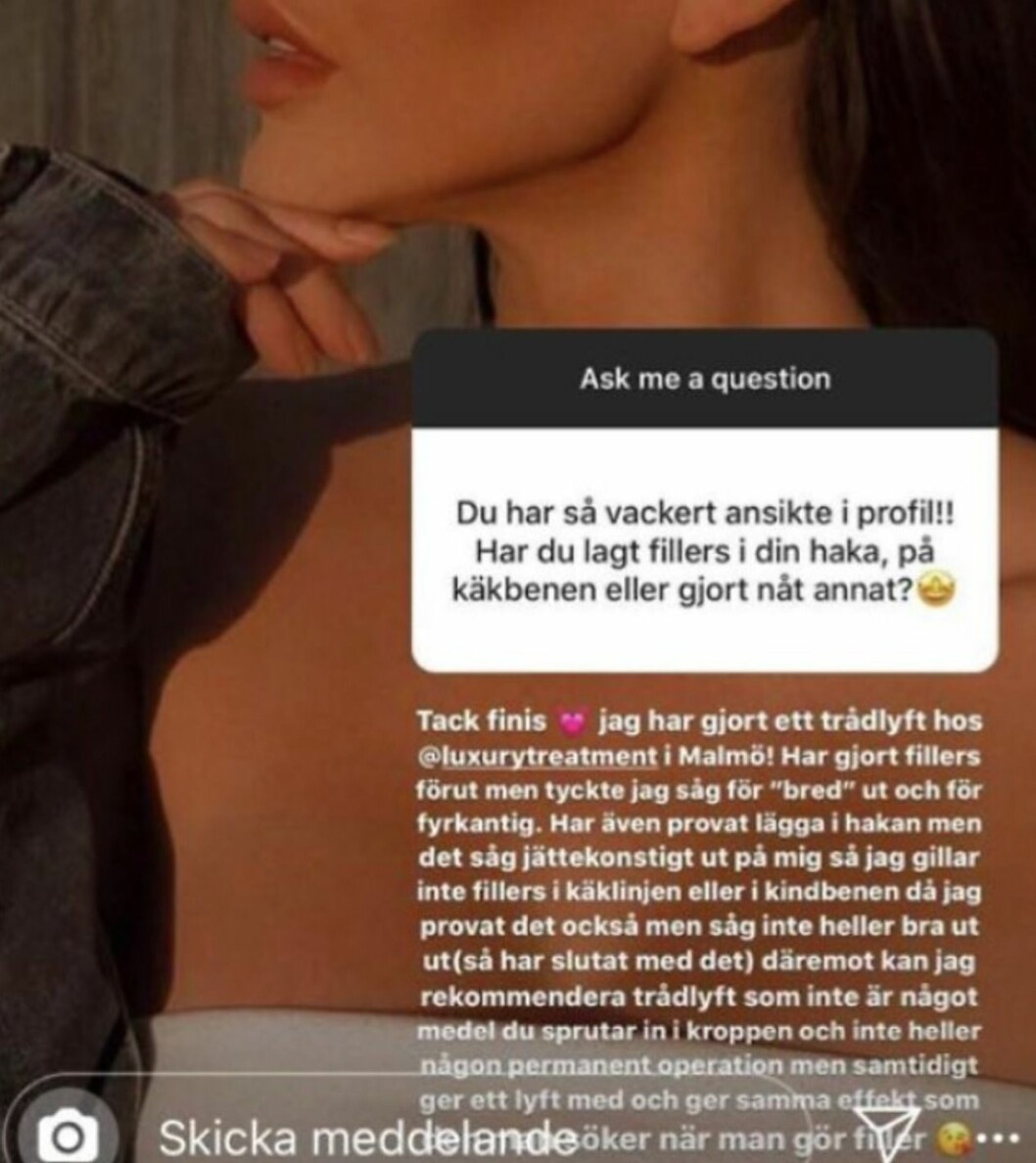Foto: Instagram Alexandra Nords Instagram story