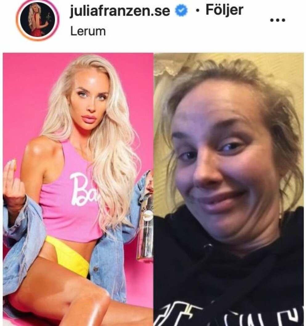 ”Jag kan ibland visa en perfekt utsida på Instagram, men det krävs lite fix och det kommer inte naturligt. Med fransar, bryn, naglar, slingor, löshår, injektionsbehandlingar, tandblekning, brun utan sol, ansiktsbehandlingar osv osv. Med rätt styling och smink kan jag verkligen känna mig som en 10:a. Och samma kväll kan jag förvandlas till bilden till höger”, skriver Julia Franzén på sin Instagram-sida.