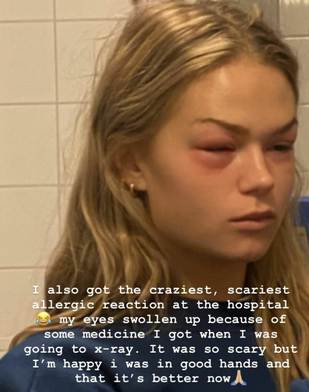 <span class=" italic" data-lab-italic_desktop="italic">Hanna visar upp skräckbilderna. FOTO: Hanna Schönberg/Instagram</span>