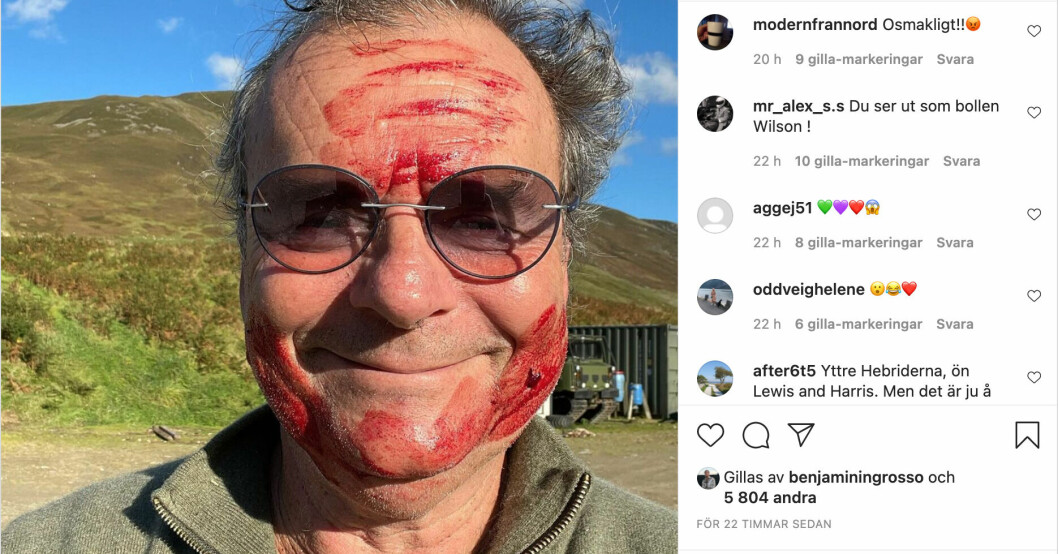 Steffos nya bild uppskattades inte riktigt av alla följare. STEFFO TÖRNQUIST