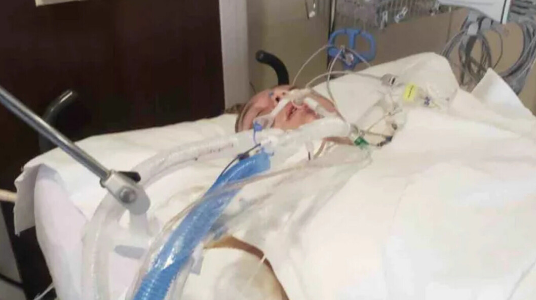 Den 20-åriga kvinnan sprang efter sin hund som hade slitit sig. De hamnade båda i det brännheta vattnet. Kvinnan befinner sig nu i medicinsk koma. Hunden överlevde inte.