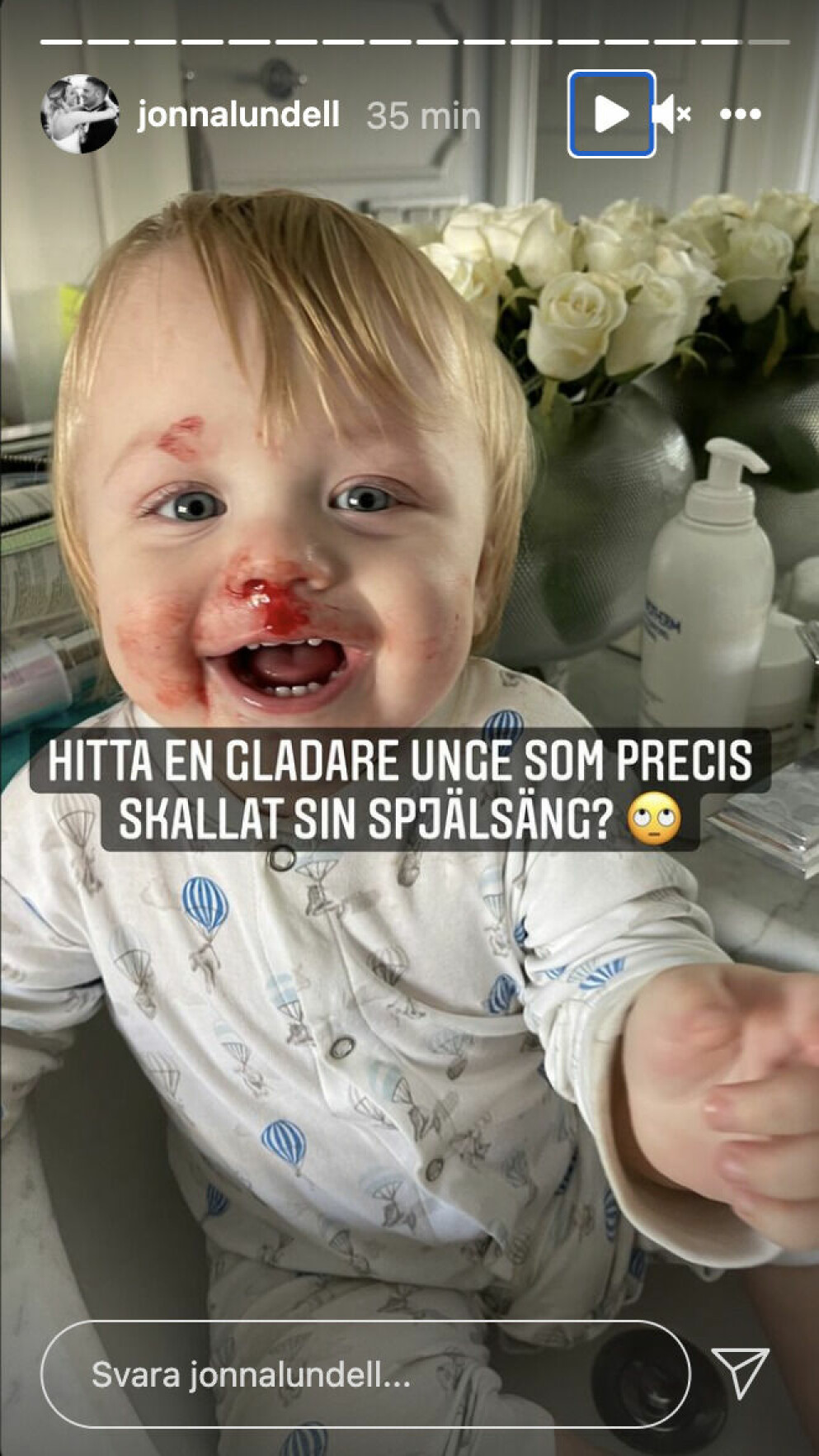 Lionel Lundell har skallat in i sin spjälsäng förklarar Jonna på Instagram.