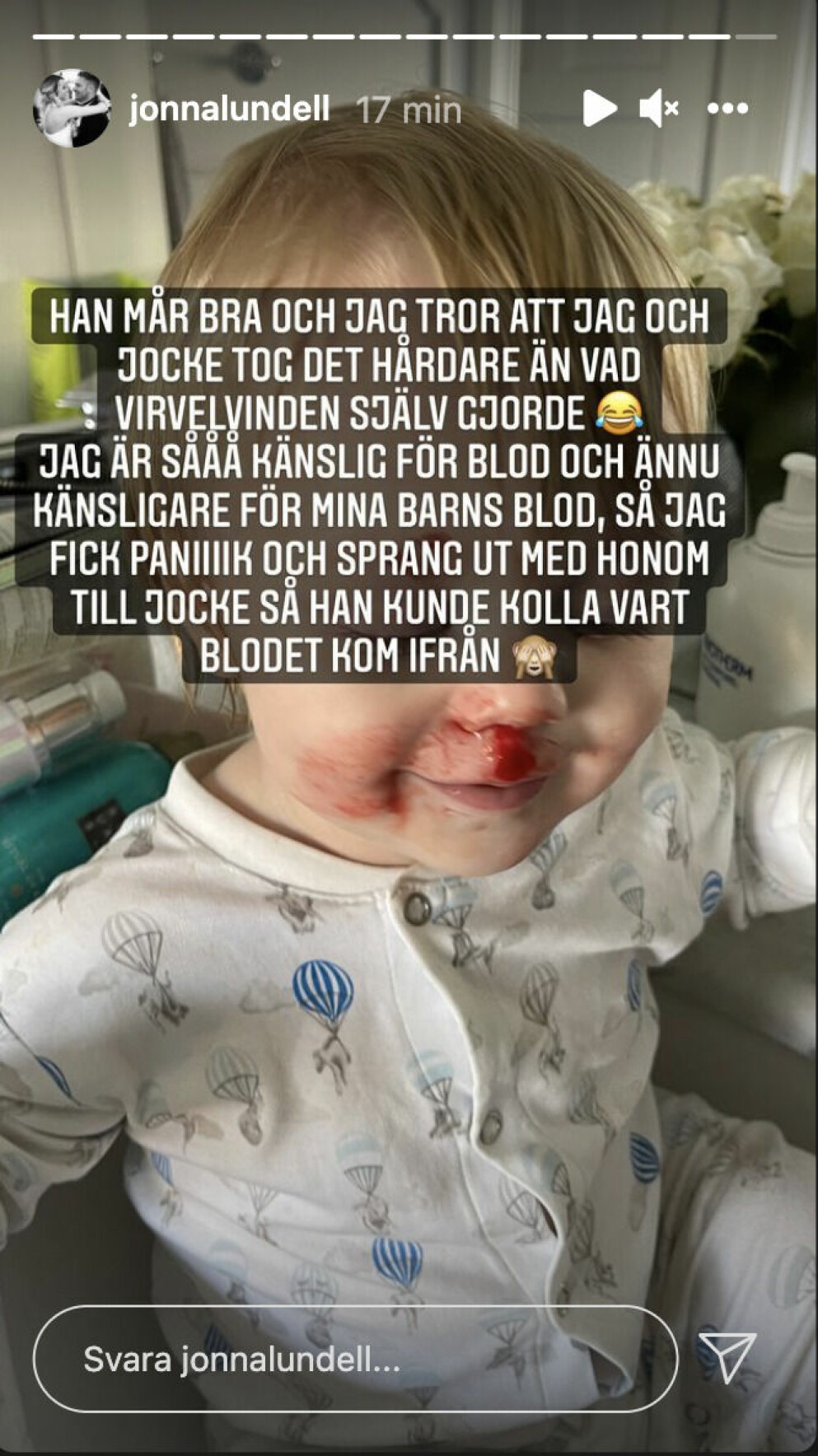 Lionel Lundell har råkat göra sig illa på sin egen spjälsäng.