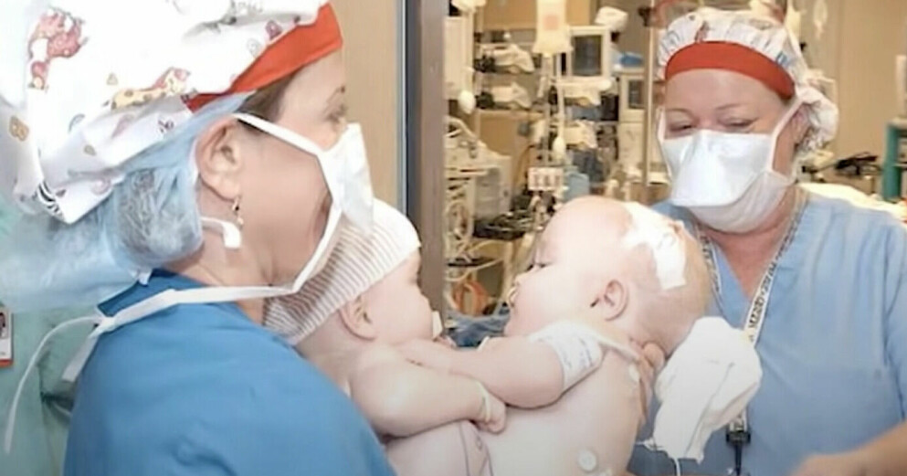 Siamesiska tvillingarna Mackenzie och Macey behövde göra en omfattande operation tio månader efter födseln. Det var inte säkert de skulle överleva. Men allt gick bra och i dag är de 18 år gamla. Mackenzie och Macey