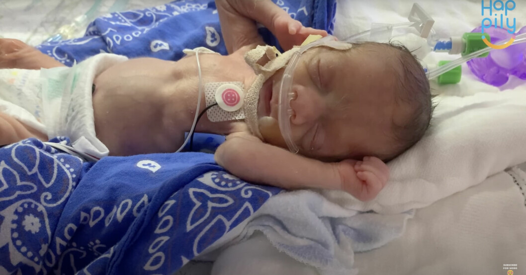 Jayden föddes flera månader för tidigt och vägde bara 800 gram vid födseln. Jayden