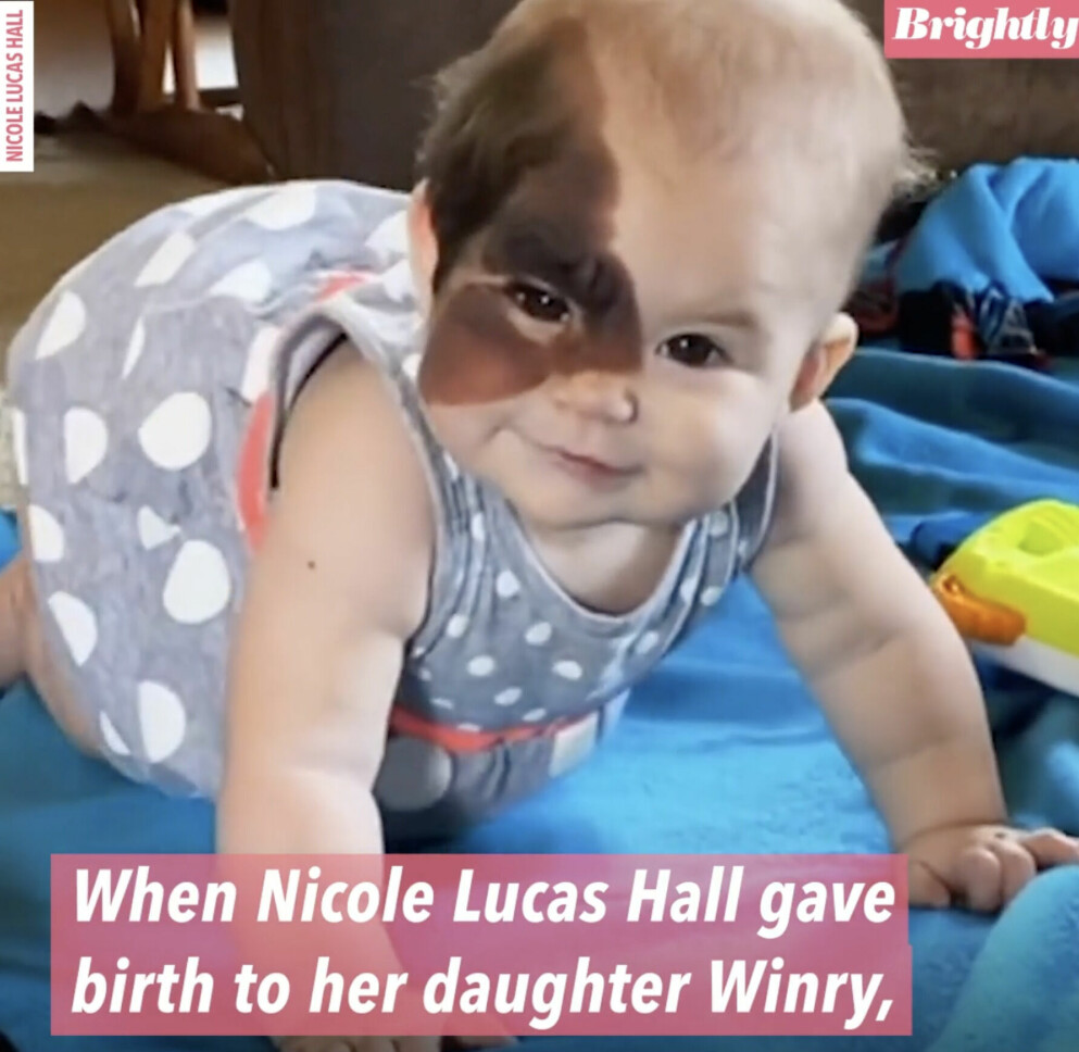 Nicole Hall är orolig att dottern ska bli mobbad när hon börjar skolan. Winry Hall