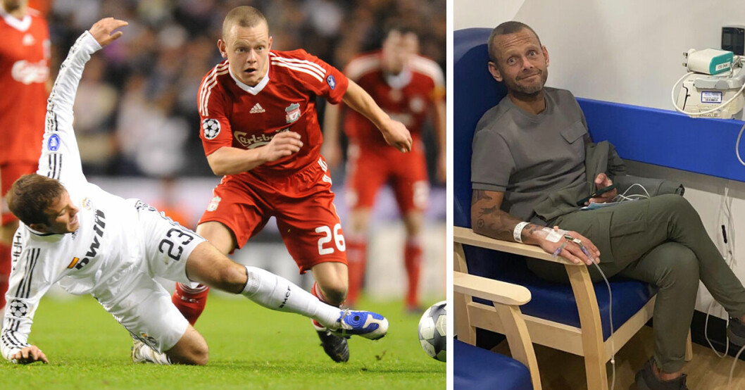 Före detta Liverpool-spelaren Jay Spearing har drabbats av Addisons sjukdom