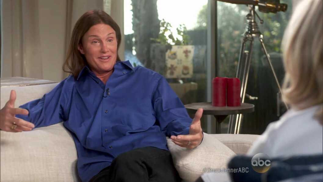 Bruce Jenner genomgick en operation för att ge sitt ansikte ett mjukare utseende. Foto: Stella Pictures Bruce Jenner genomgick en operation för att ge sitt ansikte ett mjukare utseende. Foto: Stella Pictures
