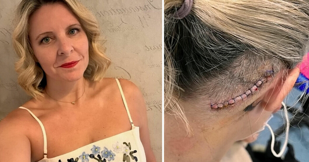 Sue trodde yrseln var öroninfektion – kan inte längre gråta efter mardrömsbeskedet.