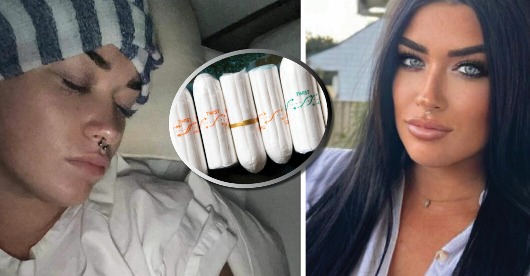 29-åring glömde kvar tampong i månader – nära att dö