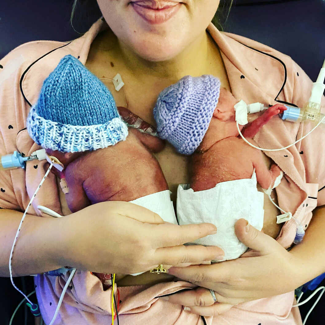 Tvillingarna Harley och Harry föddes redan i vecka 22 – och var rekordsmå. Enligt deras läkare var de i samma storlek som en chokladkaka Mars.