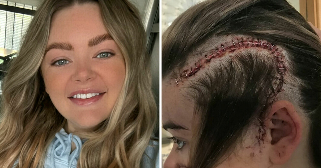 Jade McMaster hade huvudvärk i fem år – sedan fick hon mardrömsbeskedet