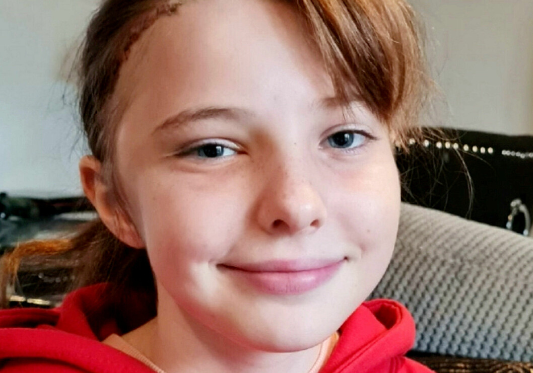 12-åriga Grace Kelly skulle på ett rutinbesök på Specsavers när hennes optiker hittade en svullnad. Det visade sig vara en tumör bakom hennes öga stor som en 10-krona.