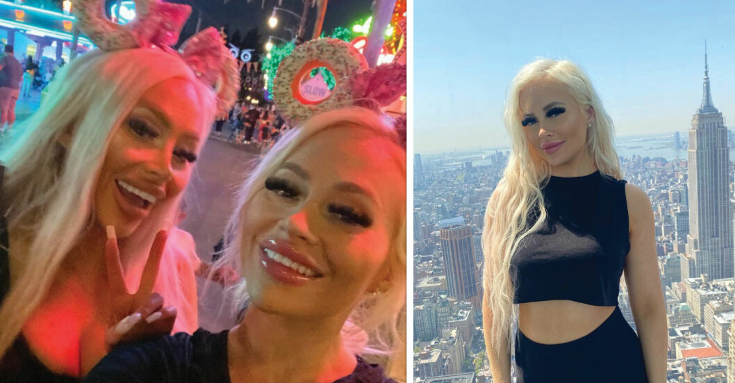 Tvillingarna har opererat sig för 2,2 miljoner – för att se ut som Barbie: ”Inte klara”