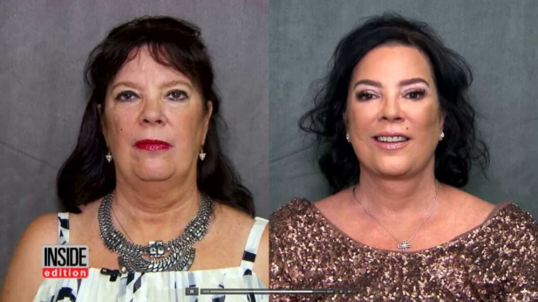 Efter operationen är Karen Houghton väldigt nöjd – och väldigt lik Kris Jenner. Efter operationen är Karen Houghton väldigt nöjd - och väldigt lik Kris Jenner.