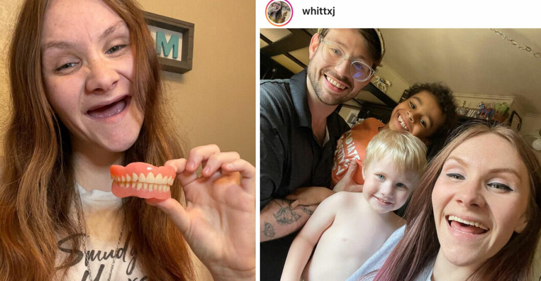 Whitney Johnson med familj. Hon drog ut alla tänder när hon var 25 år.
