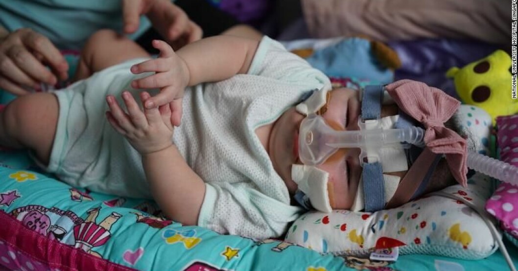 Kwek Yu Xuan behandlades länge på National University Hospital i Singapore. I dag har 212 gram blivit 6,3 kilo och hon har äntligen skrivits ut från sjukhuset. Kwek Yu Xuan