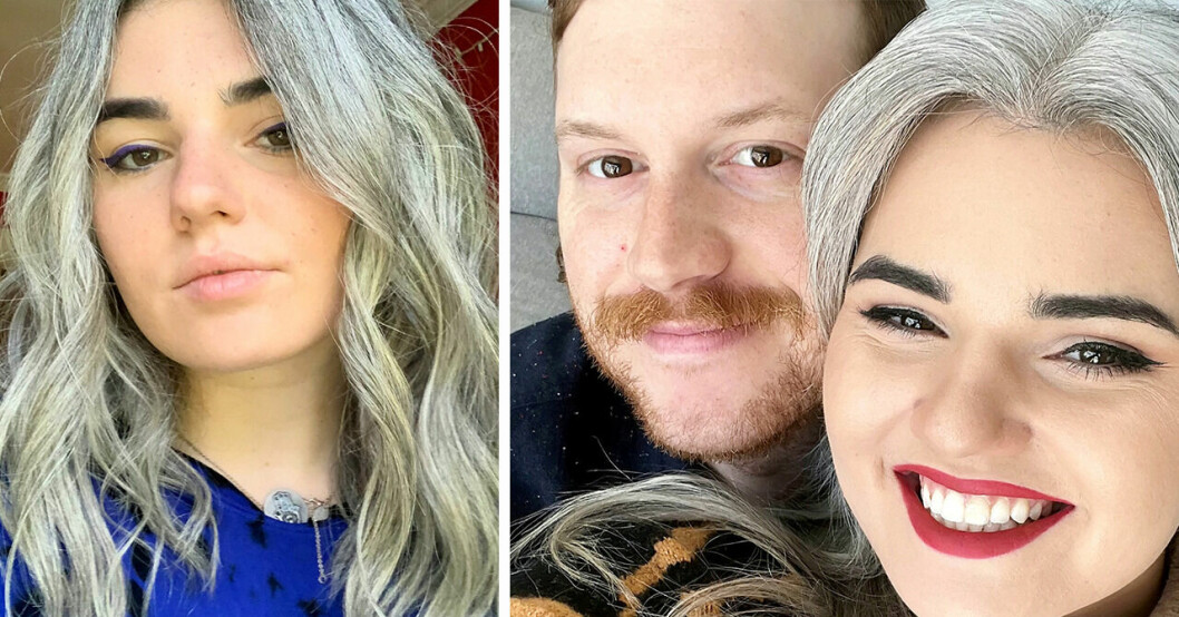 Zoë Miolla fick sitt första gråa hårstrå som 9-åring – nu är hon helt gråhårig.